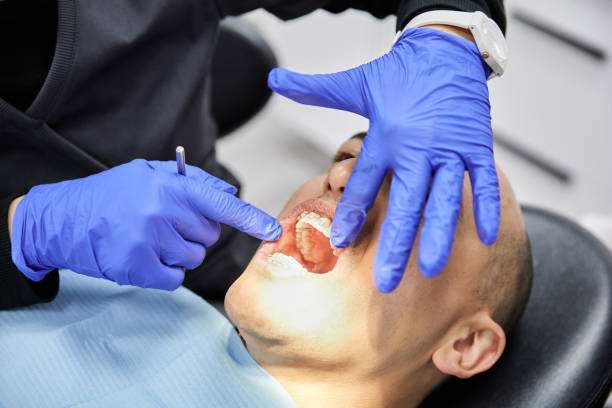 Best Knocked-Out Tooth Emergency  in Whitewater, CA